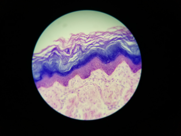 Stratified Squamous Epithelium Slides - Stratified Squamous Epithelium 13 400X